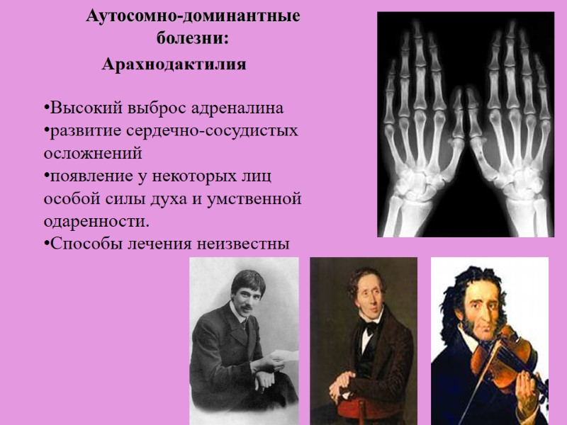 Арахнодактилия Высокий выброс адреналина развитие сердечно-сосудистых осложнений  появление у некоторых лиц особой силы